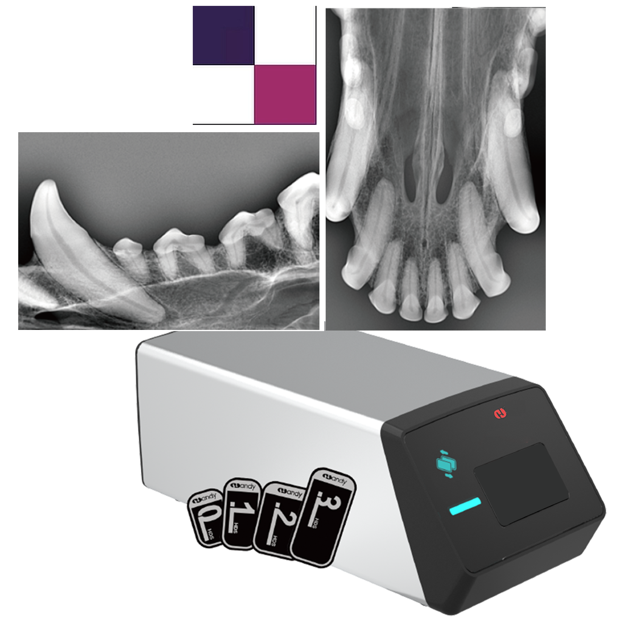 Röntgenscanner PSP-Scanner für Intra- und extraorale Speicherfolien